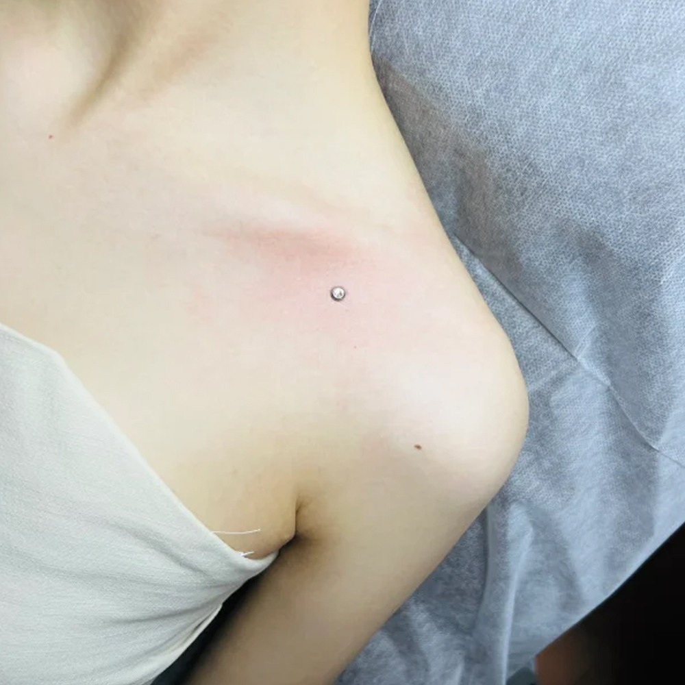 Surgical Steel Surface Piercin - Body Jewelry Dermal recensione e prezzo